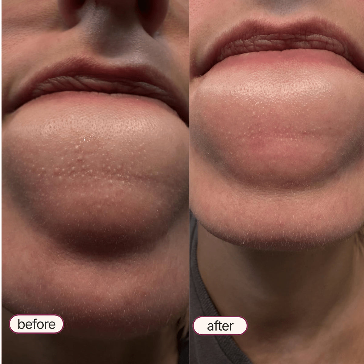 Korean Exfoliant Peel Shot